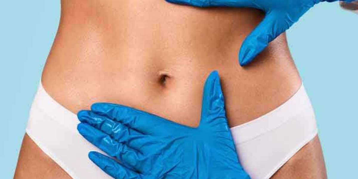 Get Rid of Unwanted Fat! Get Liposuction, At The Beauty & The Cut Clinic