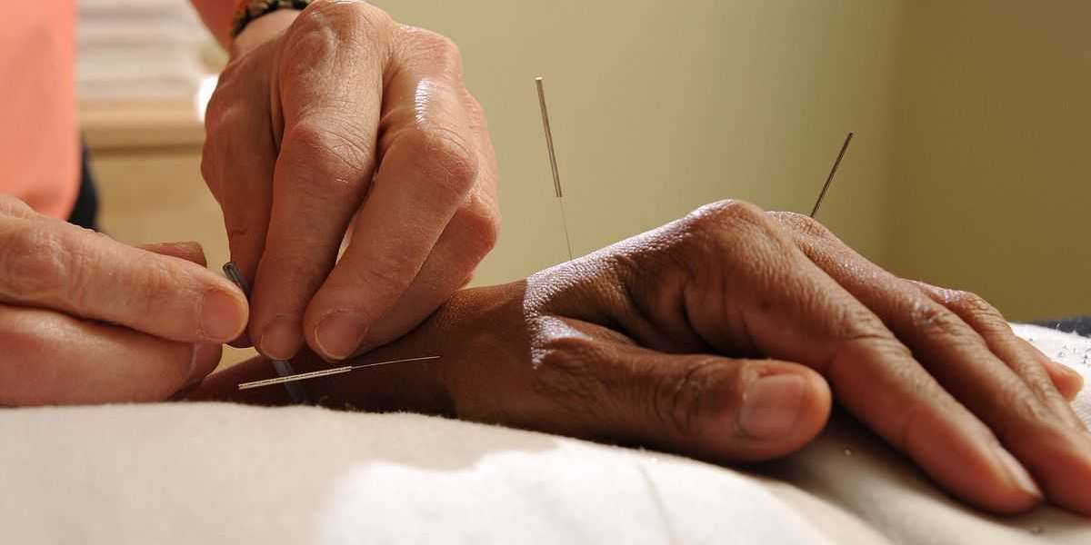 What are acupuncture 's positive effects on health?