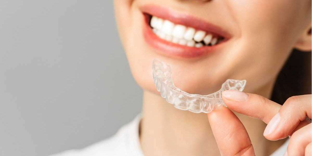 Invisalign Cost Guide: How Much Should You Expect to Pay?
