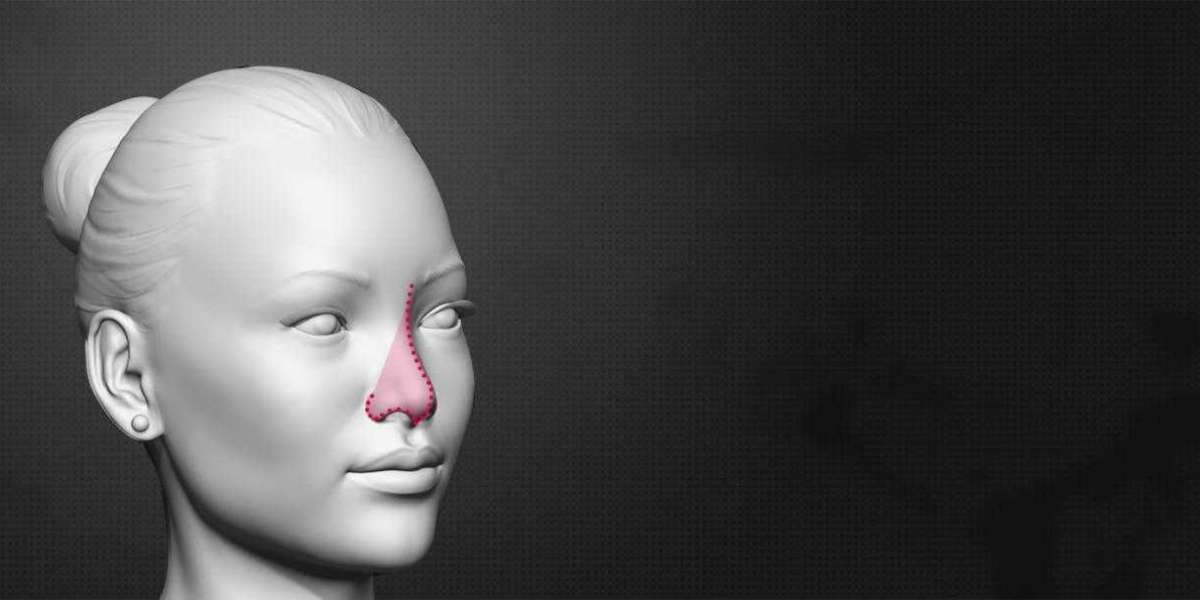 Debunking Myths and Misconceptions about Feminizing Rhinoplasty