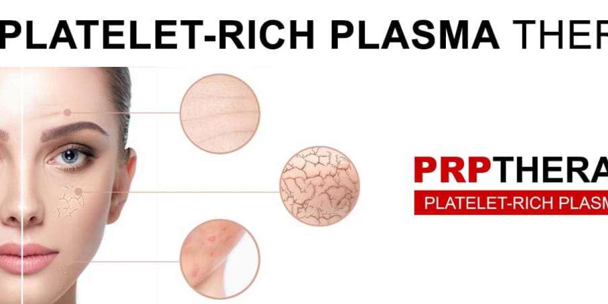 prp treatment for face