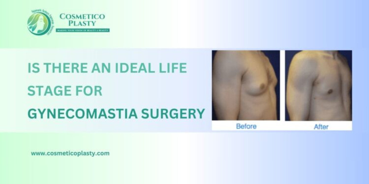 Is There an Ideal Life Stage for Gynecomastia Surgery?