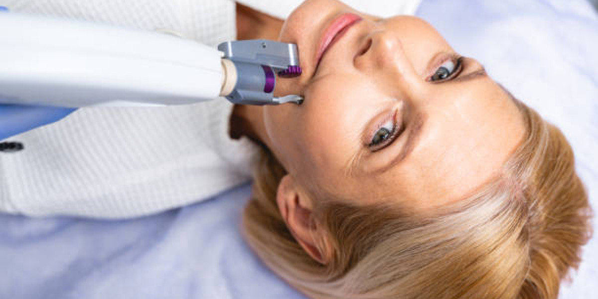 Laser Hair Removal: Unveiling the Future of Smooth Skin