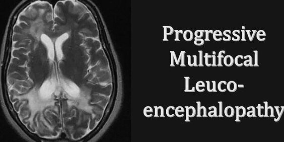 Progressive Multifocal Leukoencephalopathy Treatment Market by 2033