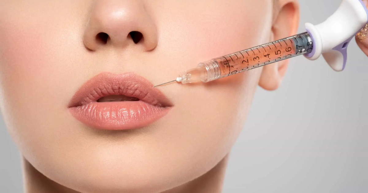 How Permanent Lip Enlargement is Changing Faces