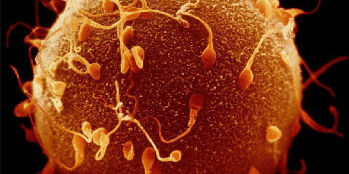 Can male infertility be cured completely?