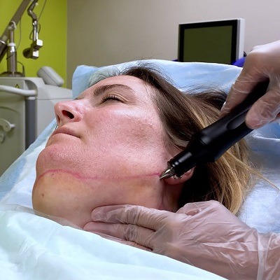 How to Get Rid of a Double Chin Removal in Dubai & Abu Dhabi | Cost