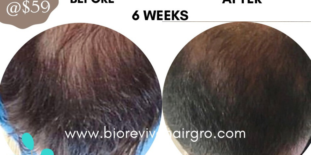 Revitalize Your Locks: BioRevive HairGro's Top 10 Benefits