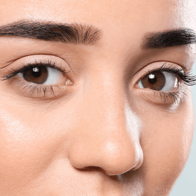 The Impact Of Eyelid Surgery In Dubai & Abu Dhabi | Price & Cost