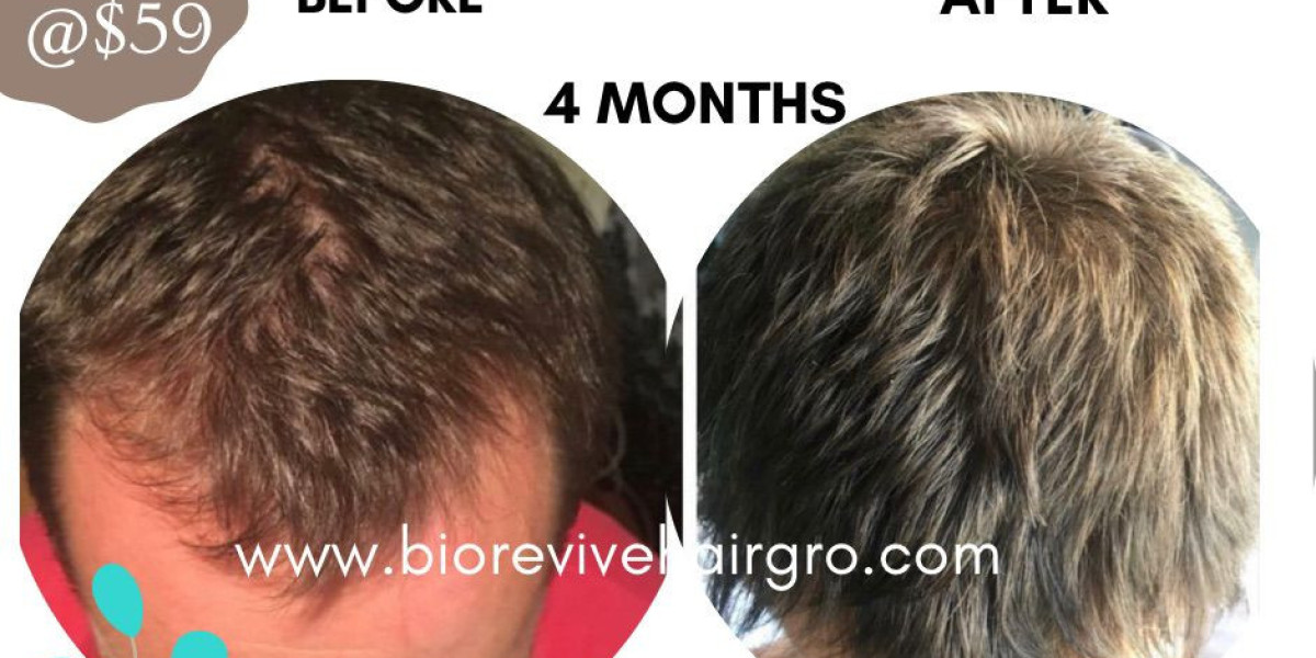 BioRevive HairGro's Top 10 Transformative Effects