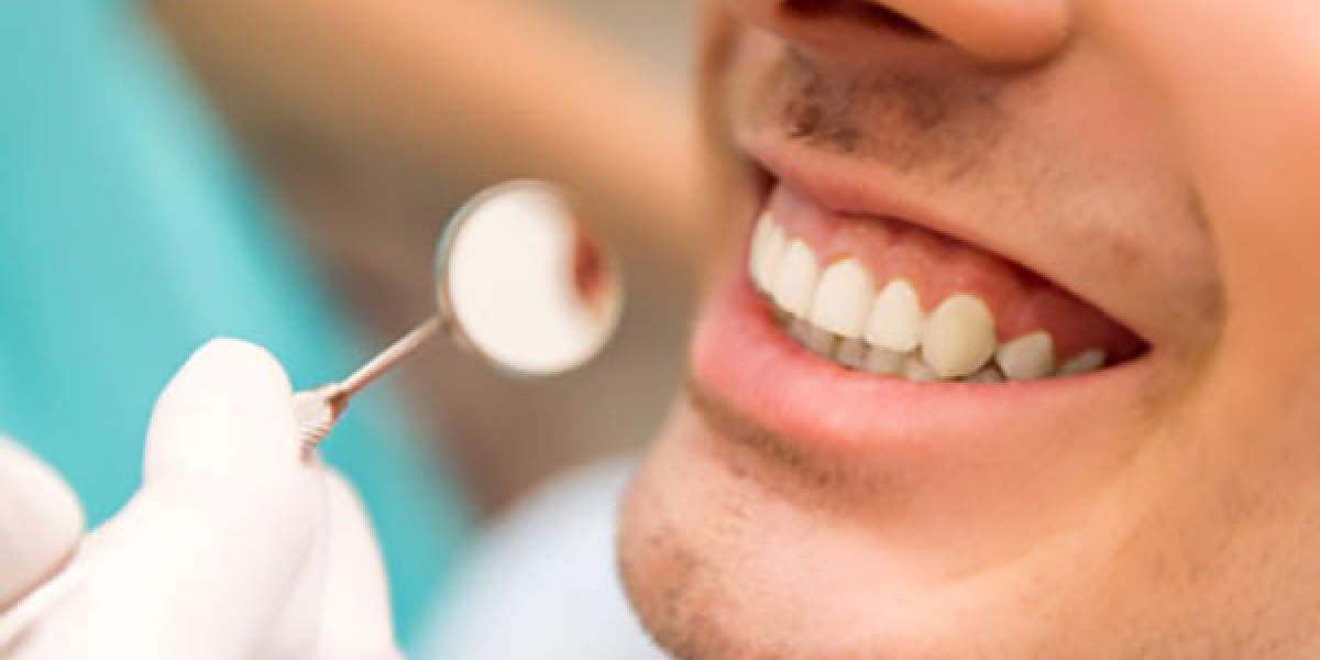 The Ultimate Guide to Laser Gum Surgery NYC: Benefits and What to Expect