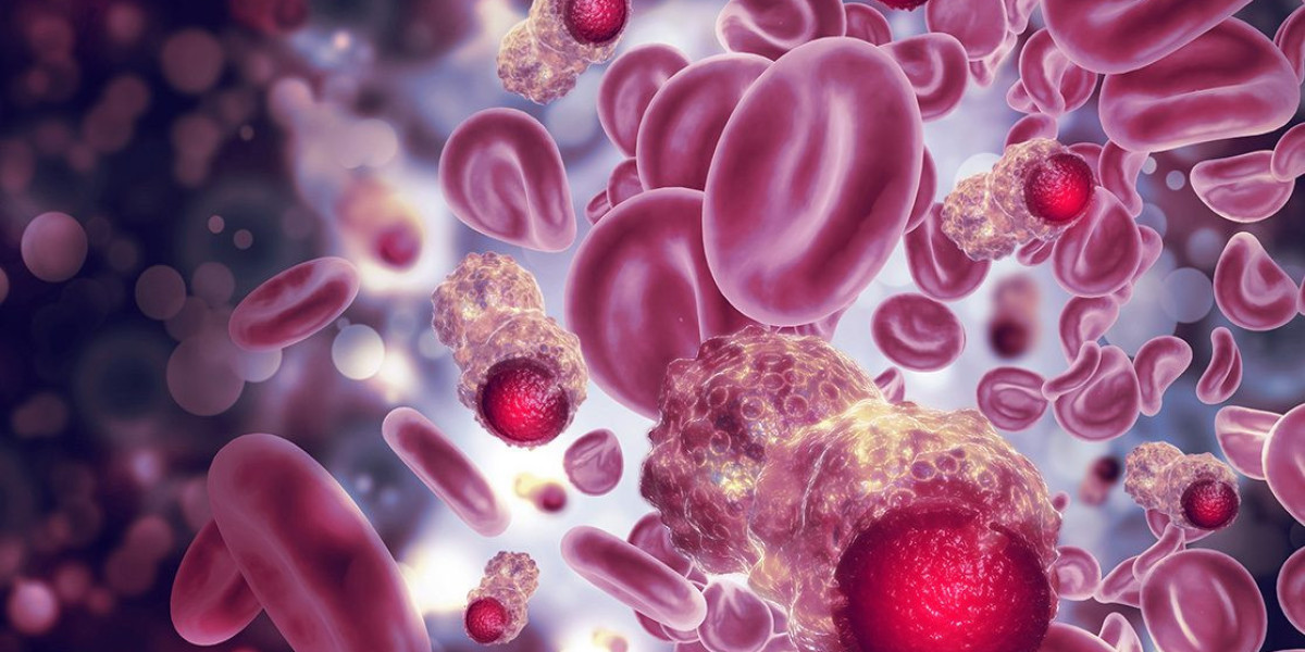 Multiple Myeloma Market Report: Epidemiology, Industry Trends, Share, Size, Demand (2024-2034)