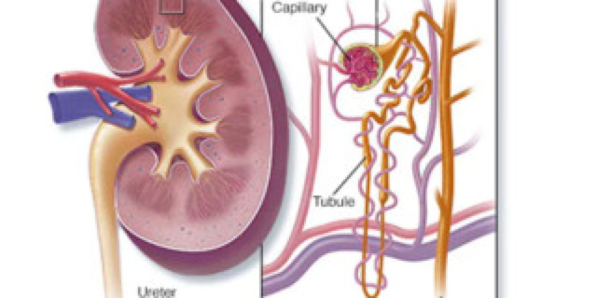 What Is The Treatment Of Acute Kidney Failure Treatment In Pune?